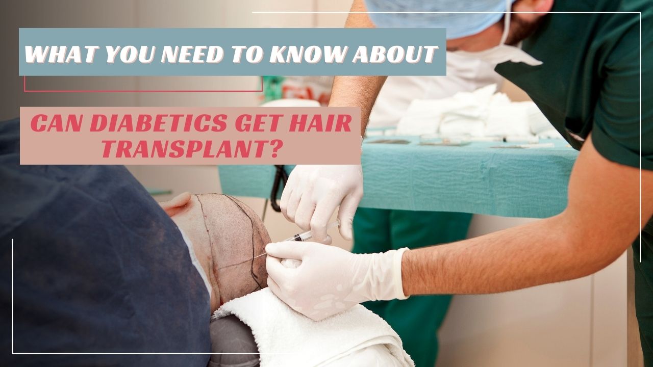 Can Diabetics Get Hair Transplant