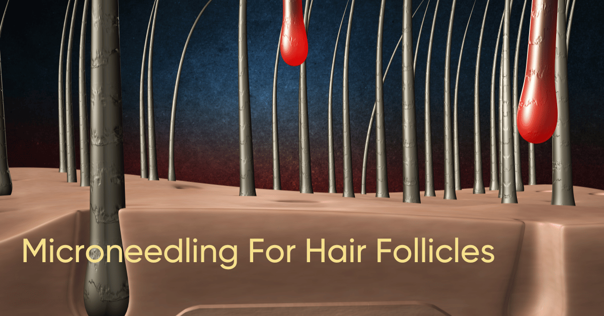 can microneedling damage hair follicles