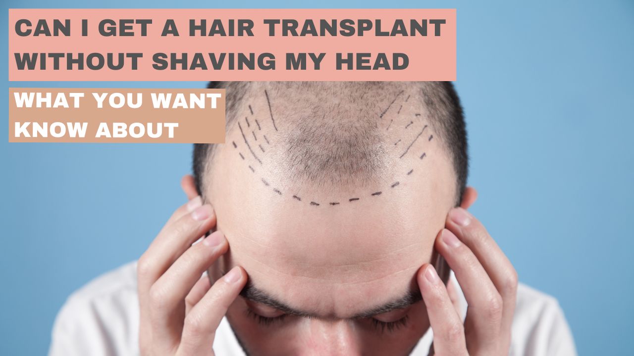 Can I Get a Hair Transplant Without Shaving My Head
