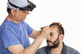 Hair Transplant Doctors Near Me: Your Guide to Choosing the Right Hair Surgeon