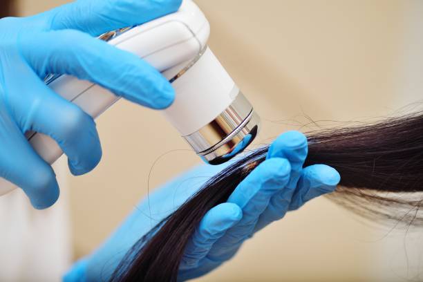 Micro Follicle Hair Transplant: Breakthrough for Thinning Hair & Baldness