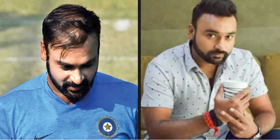 Amit Mishra Hair Transplant: The Secret Behind His Perfect Looks